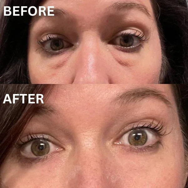Skinuretic™ - Instant Firm Collagen Eye Patches