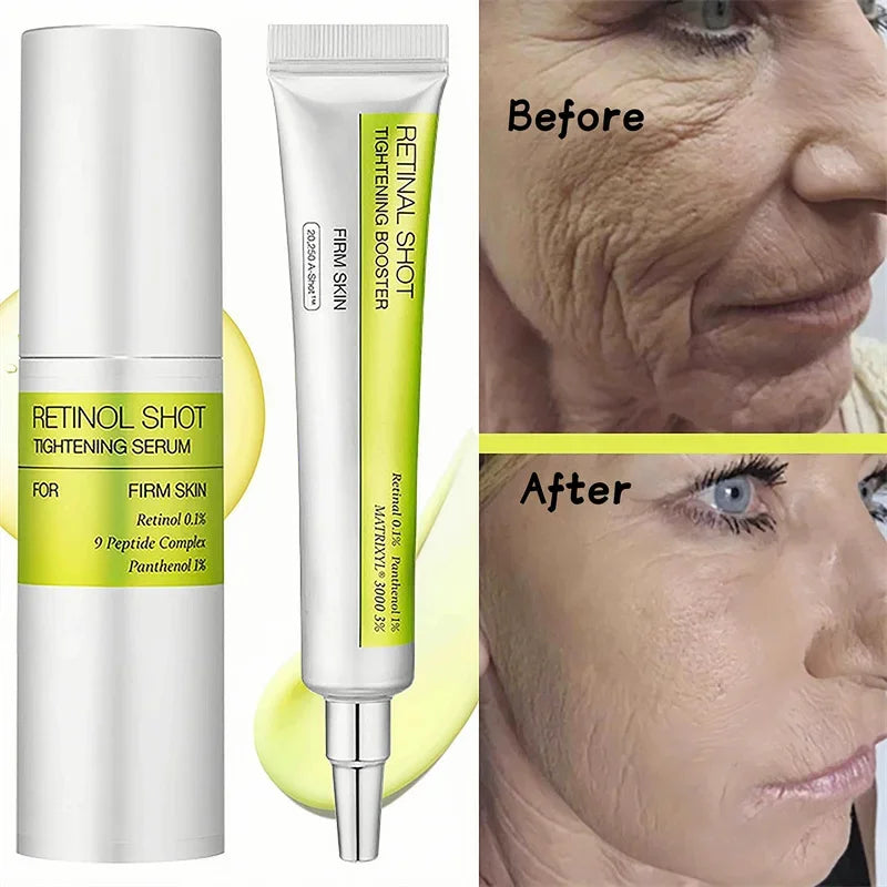Skinuretic™ - Vita A Retinal Shot Tightening Serum