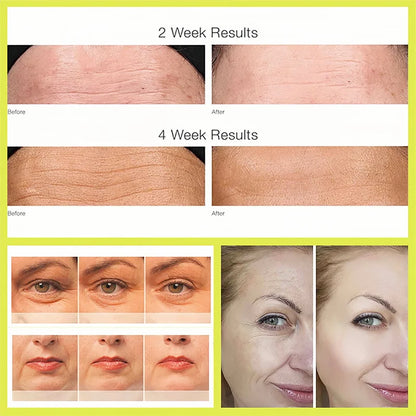 Skinuretic™ - Vita A Retinal Shot Tightening Serum